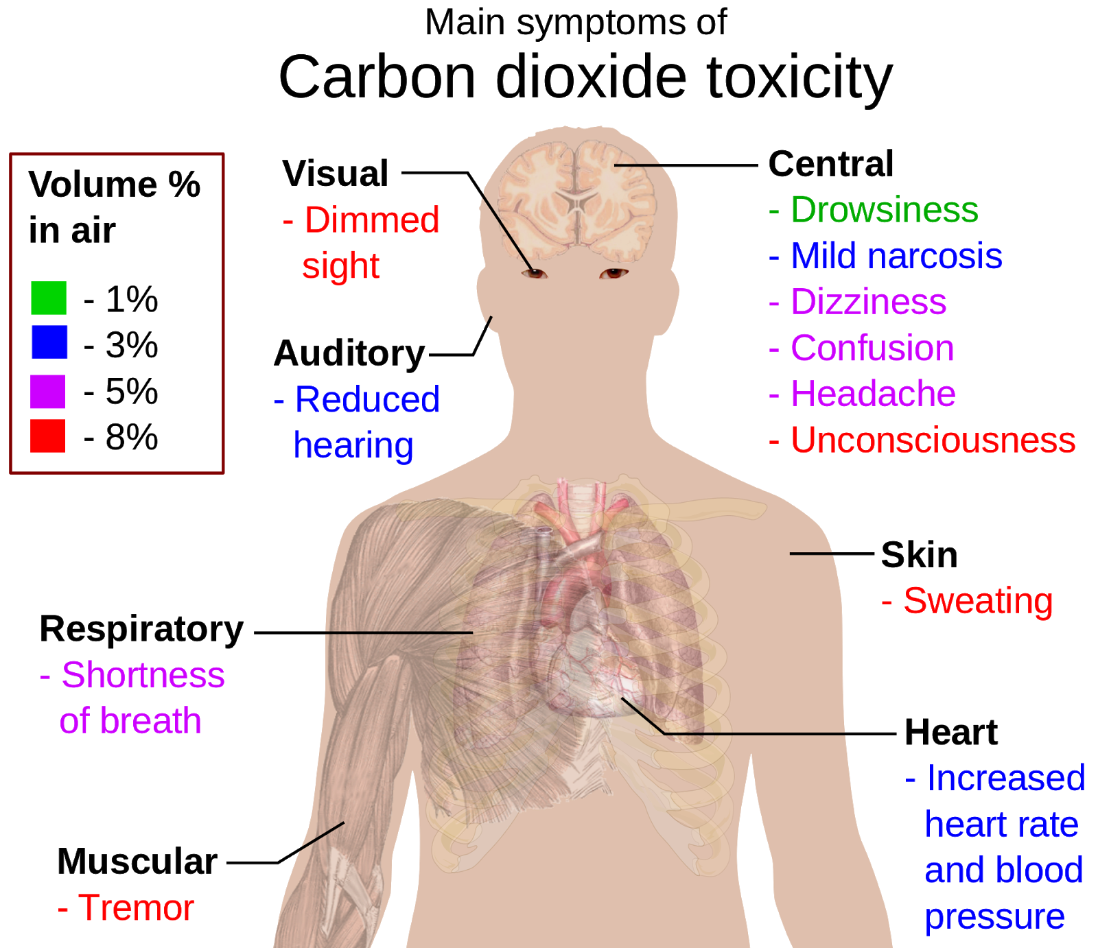 carbon dioxide poisoning and esentio