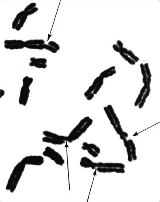 chromosomes damaged by gamma ray radiation