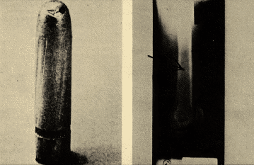 IMG#s 4-5: miracle bullet & its X-ray fragment
